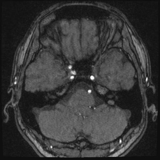 Click on the Serie image to view the images of VILLANUEVA, WILLIAM A.